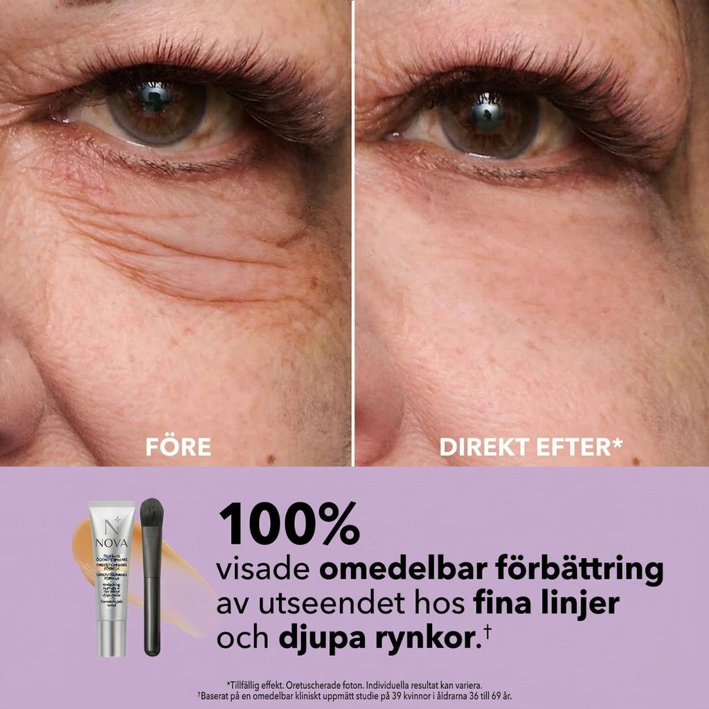 Nova™ - Huduppstramande kräm