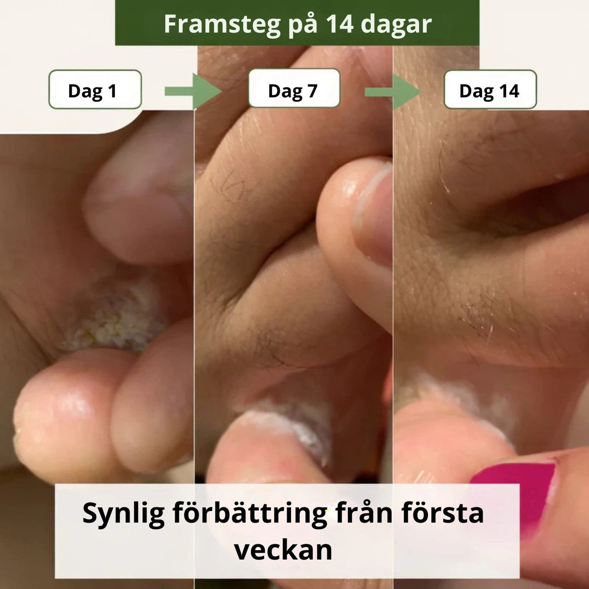 Nova svampdödande tvål