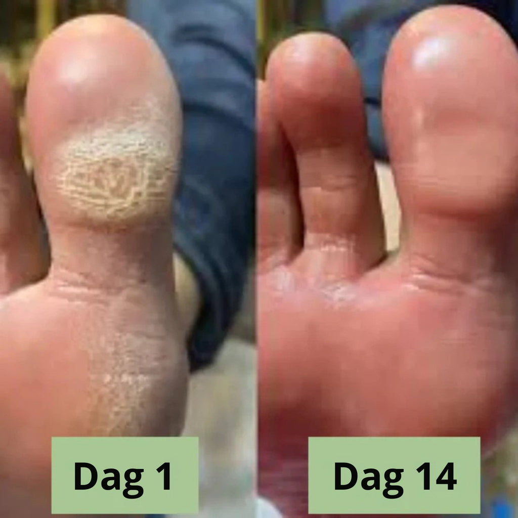 Nova svampdödande tvål