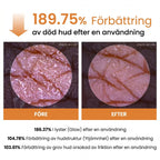 Peel Shot exfolierande spray med kojinsyra och gurkmeja