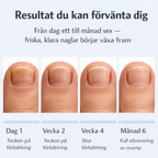 Nova™ Antisvamppenna