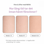 NOVA™ IPL Hårborttagning — Permanent silkeslen hud hemma