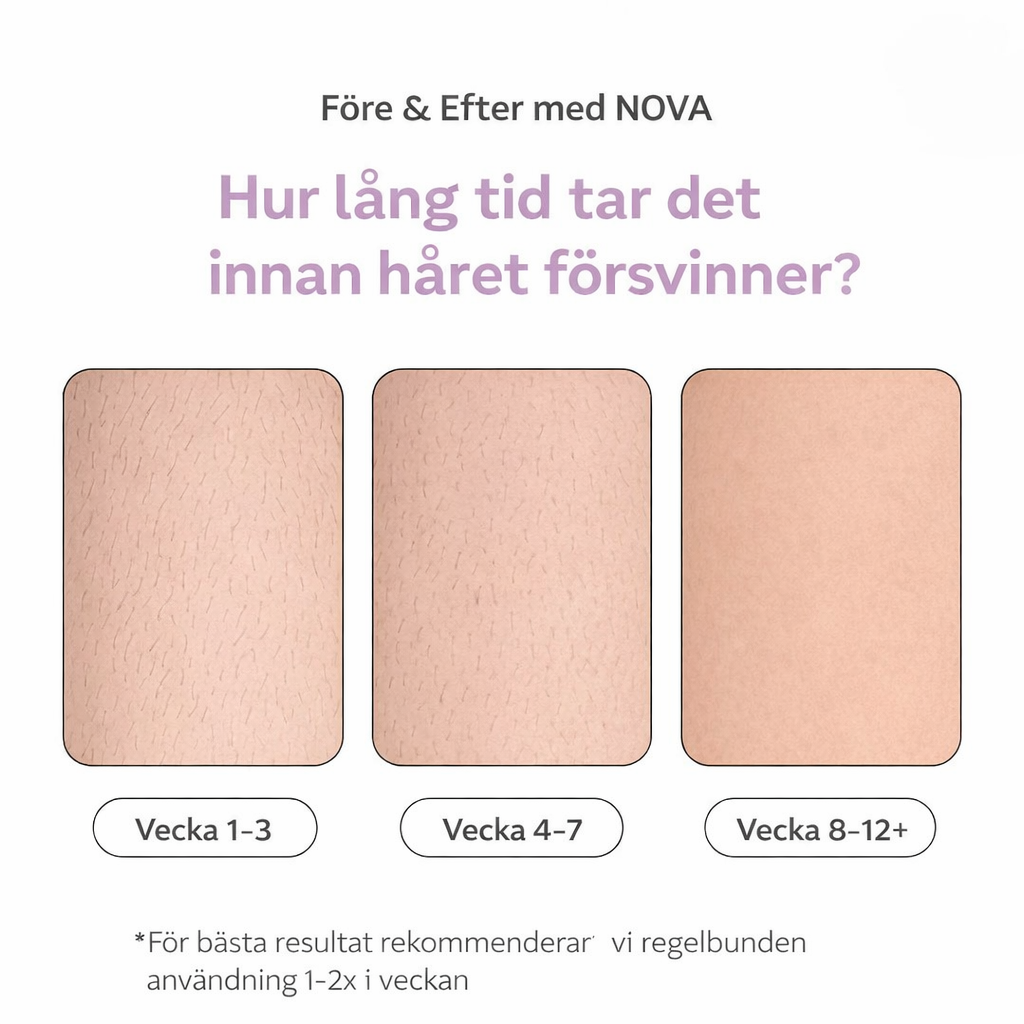 NOVA™ IPL Hårborttagning — Permanent silkeslen hud hemma