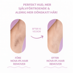 NOVA™ IPL Hårborttagning — Permanent silkeslen hud hemma