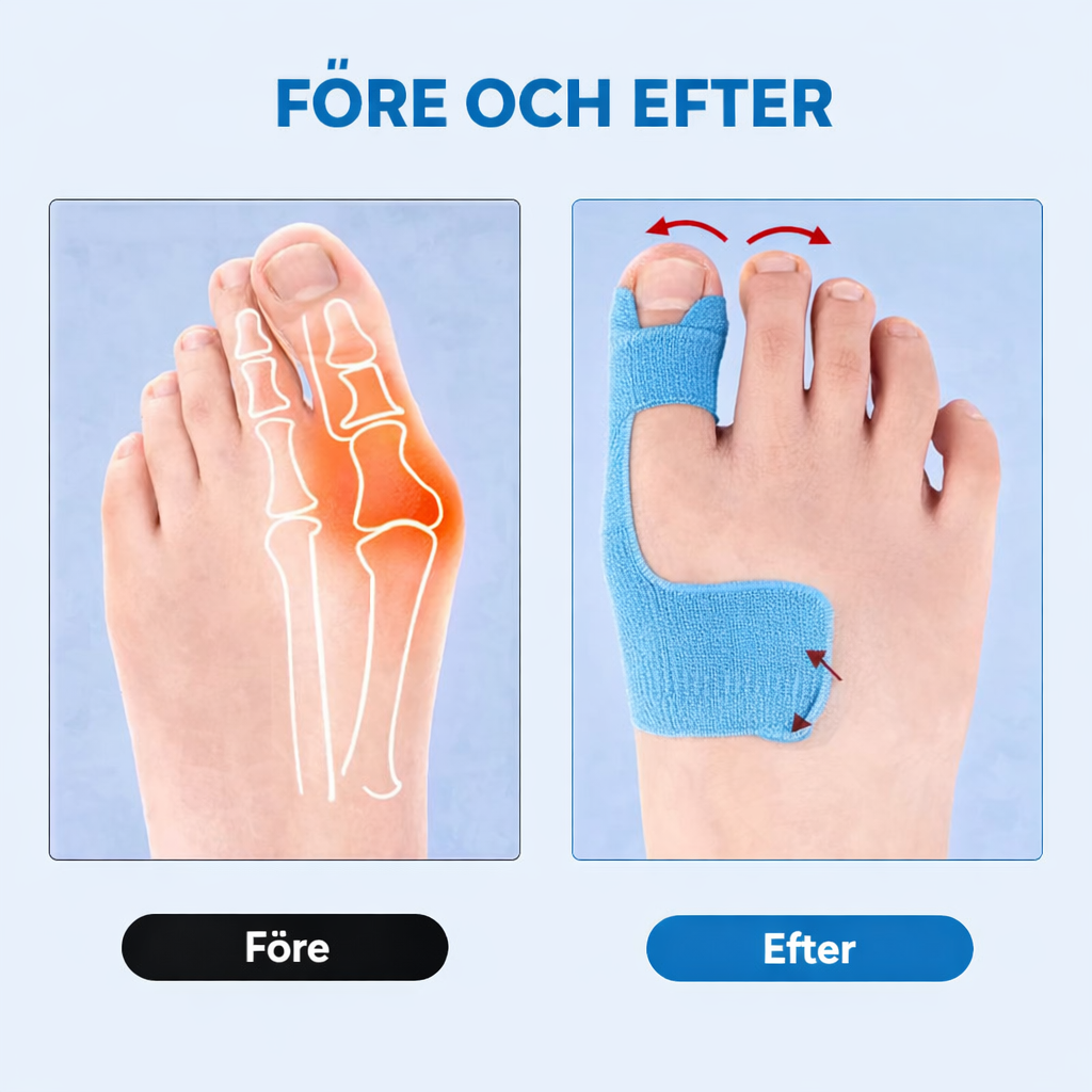 NOVA HalluxFix Pro – Förskuren Kinesiotejp för Hallux Valgus