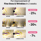Nova Collagen EyePatch — Återfuktande Ögonmask