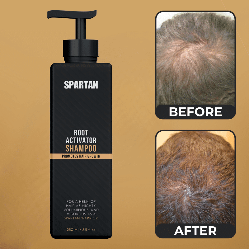 SPARTAN™ - Root Activator Shampoo