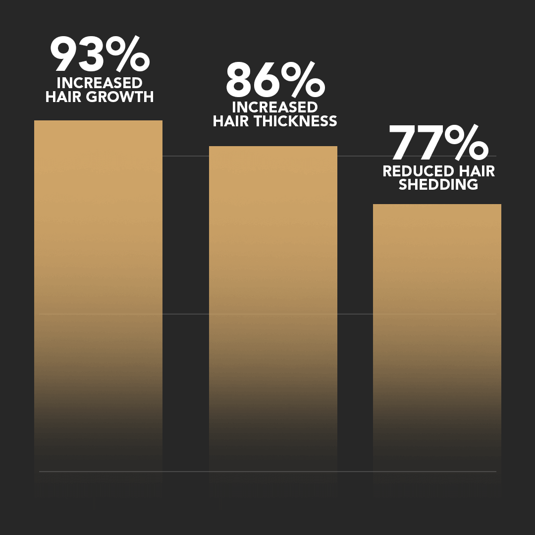 SPARTAN™ - Root Activator Shampoo