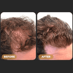 SPARTAN™ - Root Activator Shampoo