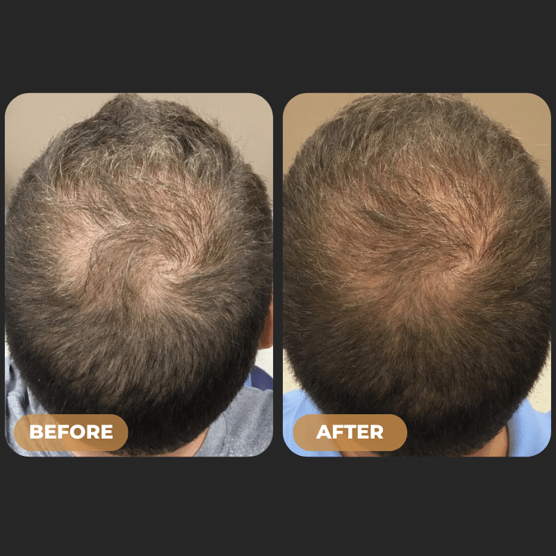 SPARTAN™ - Root Activator Shampoo