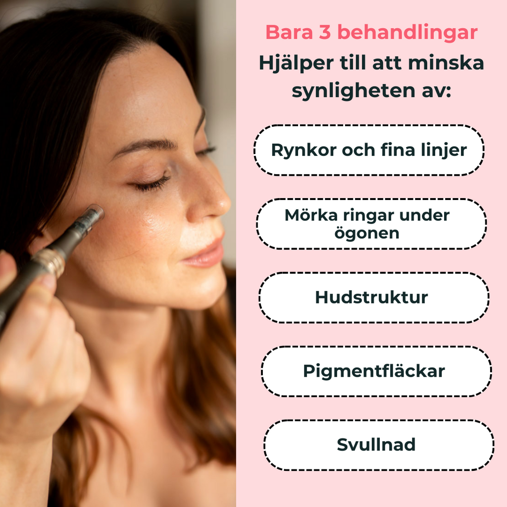 Professionell dermapen + 4 gratis gåvor
