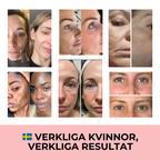 Professionell dermapen + 4 gratis gåvor