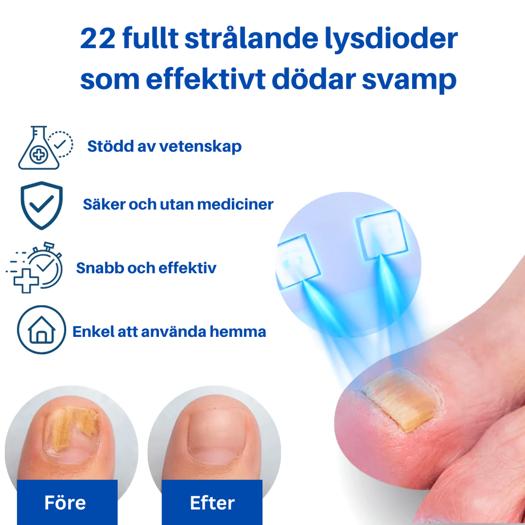 OnlyClear™- Laser mot nagelsvamp