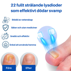 OnlyClear™- Laser mot nagelsvamp