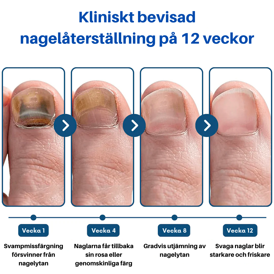 OnlyClear™- Laser mot nagelsvamp