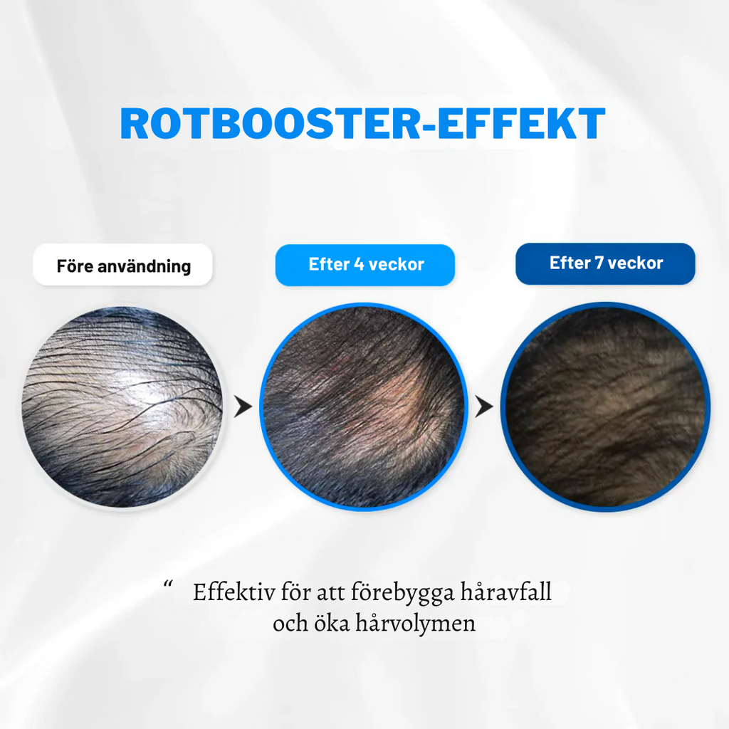 Nova© Hårväxtampull för Hårbotten