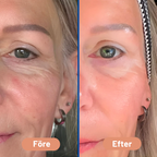 NOVA™ – Silikonförband 1+1 Gratis