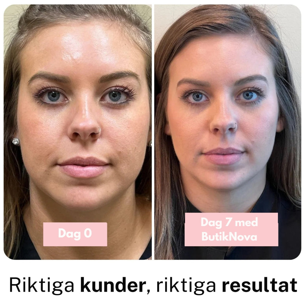 Collagen Anti‑Age Stav