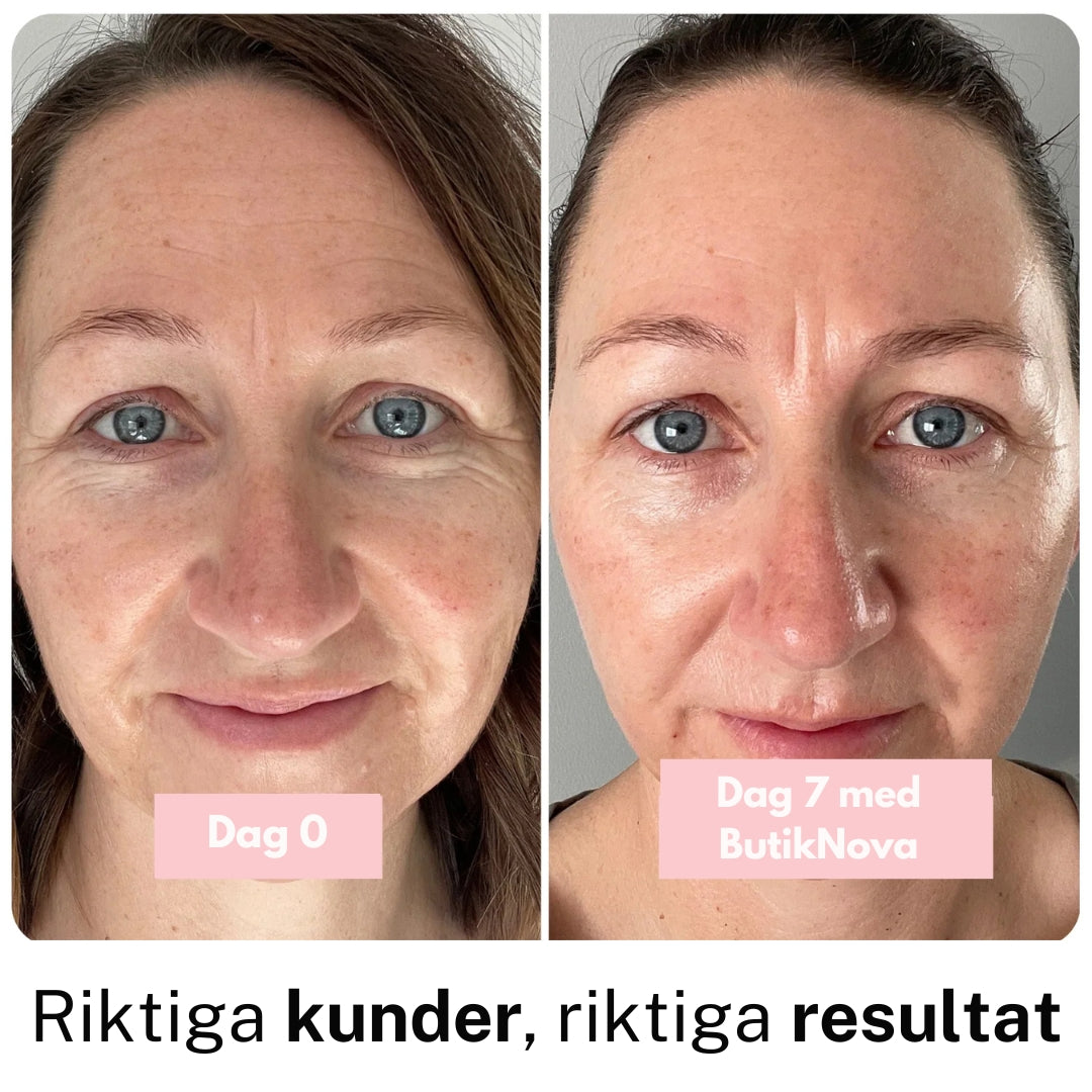 Collagen Anti‑Age Stav