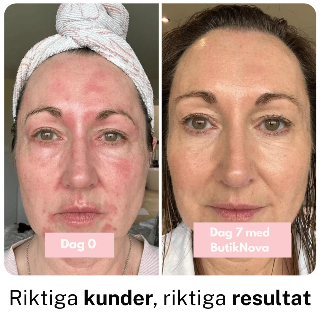 Collagen Anti‑Age Stav