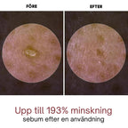 Dr.Melaxin - Rice Peel Glow Serumampull
