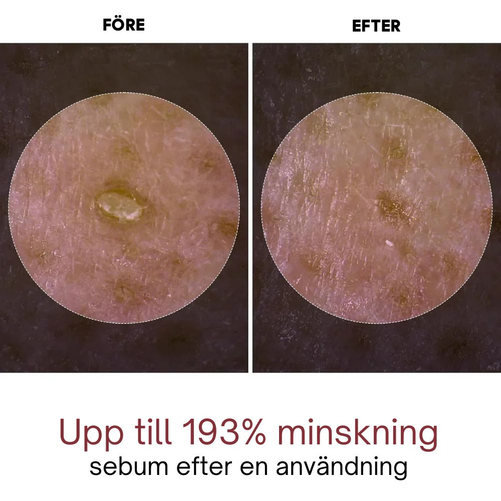 Dr.Melaxin - Rice Peel Glow Serumampull